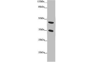 Western blot All lanes: TENT5C antibody at 2 μg/mL + Mouse heart tissue Secondary Goat polyclonal to rabbit IgG at 1/10000 dilution Predicted band size: 45 kDa Observed band size: 45, 35 kDa (FAM46C antibody  (AA 1-391))