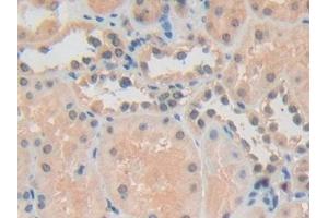 Detection of ADRM1 in Human Kidney Tissue using Polyclonal Antibody to Adhesion Regulating Molecule 1 (ADRM1) (ADRM1 antibody  (AA 2-407))