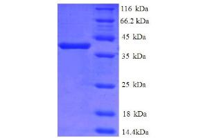 SDS-PAGE (SDS) image for Cathepsin D (CTSD) (AA 67-403), (partial) protein (His tag) (ABIN5712209) (Cathepsin D Protein (CTSD) (AA 67-403, partial) (His tag))