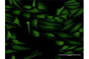 Immunofluorescence of purified MaxPab antibody to ProSAPiP1 on HeLa cell. (ProSAPiP1 antibody  (AA 1-673))