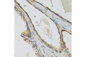 Immunohistochemistry of paraffin-embedded human prostate using PTK7 antibody (ABIN6003571) at dilution of 1/100 (40x lens). (PTK7 antibody)