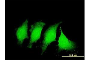 Immunofluorescence of monoclonal antibody to IL1B on HeLa cell. (IL-1 beta antibody  (AA 170-269))