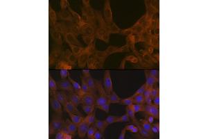 Immunofluorescence analysis of NIH-3T3 cells using B Rabbit mAb (ABIN1678826, ABIN3015929, ABIN3015930 and ABIN7101463) at dilution of 1:100 (40x lens). (Activin A Receptor Type IB/ALK-4 antibody)