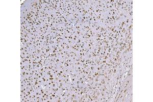 IHC analysis of SND1 using anti-SND1 antibody (ABIN7600526).