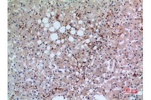 Immunohistochemistry (IHC) analysis of paraffin-embedded Human Liver, antibody was diluted at 1:100. (CD42b antibody  (Internal Region))