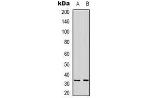 Western blot analysis of CD335 expression in A431 (A), SKOV3 (B) whole cell lysates. (NCR1 antibody)