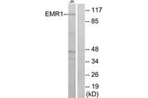 Western blot analysis of extracts from Jurkat cells, using EMR1 Antibody. (F4/80 antibody  (AA 818-867))