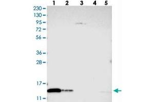 Western blot analysis of Lane 1: RT-4, Lane 2: U-251 MG, Lane 3: Human Plasma, Lane 4: Liver, Lane 5: Tonsil with TXNDC17 polyclonal antibody . (TXNDC17 antibody)