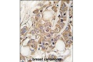 Immunohistochemistry (Paraffin-embedded Sections) (IHC (p)) image for anti-Vimentin (VIM) (AA 63-90) antibody (ABIN389211)