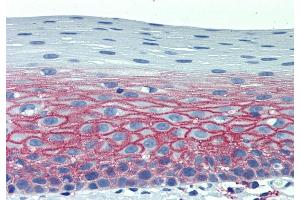 Immunohistochemistry staining of human tonsil (paraffin-embedded sections) with anti-CD82 (C33). (CD82 antibody)