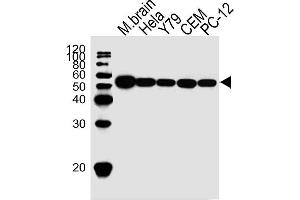 Lane 1: Mouse brain lysates, Lane 2: HeLa Cell lysates, Lane 3: Y79 Cell lysates, Lane 4: CEM Cell lysates, Lane 5: PC-12 Cell lysates, probed with TBB5 (87CT59. (TUBB antibody)