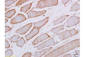 Formalin-fixed and paraffin embedded rat skeletal muscle labeled with Anti Phospho-SEK1/MKK4 (Thr261) Polyclonal Antibody, Unconjugated (ABIN702745) at 1:200 followed by conjugation to the secondary antibody and DAB staining (MAP2K4 antibody  (pThr261))