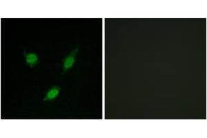 Immunofluorescence analysis of MCF7 cells, using TACC1 Antibody. (TACC1 antibody  (AA 11-60))