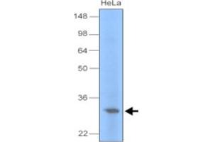 Western blot analysis of cell lysate of HeLa (30 ug) were resolved by SDS - PAGE , transferred to PVDF membrane and probed with UNG monoclonal antibody , clone k1C12 (1 : 1000) . (UNG antibody)