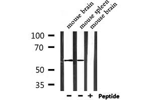 Western blot analysis of extracts from mouse brain and mouse spleen, using STAM2 Antibody.