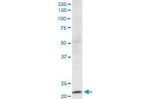 NDUFV2 monoclonal antibody (M03), clone 1A10. (NDUFV2 antibody  (AA 150-249))