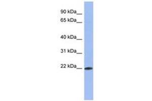 Image no. 1 for anti-RNA Binding Motif Protein 38 (RBM38) (C-Term) antibody (ABIN6743016) (RBM38 antibody  (C-Term))