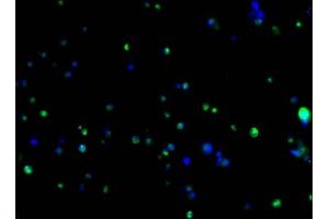 Immunofluorescence staining of 293F transfected cells with ABIN7193151 at 1:100, counter-stained with DAPI. (HA-Tag antibody)