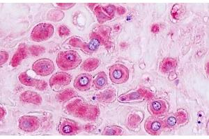 Immunohistochemistry (IHC) image for anti-Aldo-Keto Reductase Family 1, Member B1 (Aldose Reductase) (AKR1B1) (AA 241-290) antibody (ABIN2879264)
