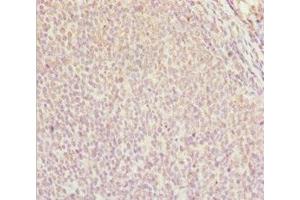 Immunohistochemistry of paraffin-embedded human tonsil tissue using ABIN7144963 at dilution of 1:100 (DDX11 antibody  (AA 1-220))