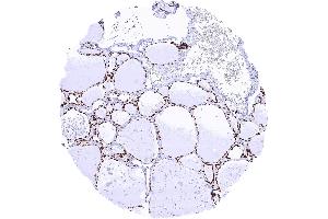 Thyroid gland with strong TTF1 staining of follicular epithelial cells (Recombinant NKX2-1 antibody)