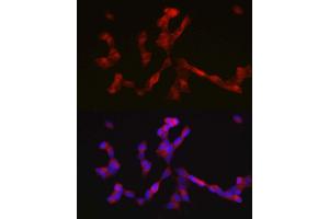Immunofluorescence analysis of SH-SY5Y cells using ALK antibody  at dilution of 1:200. (ALK antibody  (AA 19-300))