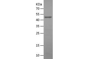 MGEA5 Protein (AA 1-209) (His-IF2DI Tag)