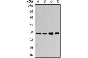 Western blot analysis of Ficolin 1 expression in HepG2 (A), mouse liver (B), mouse heart (C), rat liver (D) whole cell lysates. (FCN1 antibody)