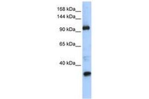 Image no. 1 for anti-Terminal Uridylyl Transferase 1, U6 SnRNA-Specific (TUT1) (AA 829-878) antibody (ABIN6740612) (TUT1 antibody  (AA 829-878))