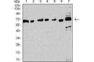 Estrogen Receptor alpha antibody  (AA 2-185)