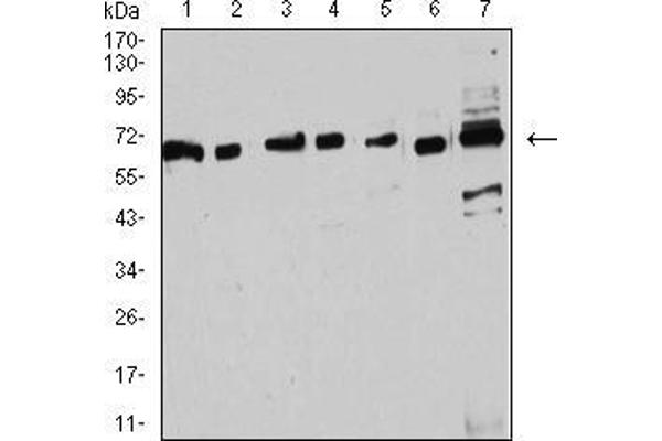 Estrogen Receptor alpha anticorps  (AA 2-185)