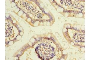 Immunohistochemistry of paraffin-embedded human small intestine tissue using ABIN7175757 at dilution of 1:100 (WDR49 antibody  (AA 251-500))
