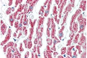 Human Heart (formalin-fixed, paraffin-embedded) stained with ACO2 antibody ABIN462115 followed by biotinylated goat anti-rabbit IgG secondary antibody ABIN481713, alkaline phosphatase-streptavidin and chromogen. (ACO2 antibody  (AA 438-467))