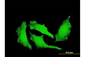 Immunofluorescence of monoclonal antibody to ATP9A on HeLa cell. (ATP9A antibody  (AA 358-456))