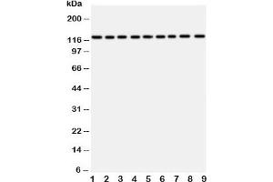 Western blot testing of TRPC3 antibody and Lane 1:  rat liver;  2: (r) lung;  3: (r) intestine;  4: (r) ovary;  5: human U87;  6: (h) A549;  7: (h) COLO320;  8: (h) SW620;  9: (h) HeLa