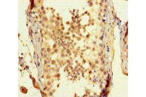 Immunohistochemistry of paraffin-embedded human testis tissue using ABIN7170512 at dilution of 1:100 (SPATA16 antibody  (AA 238-475))