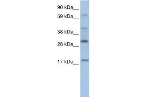 WB Suggested Anti-PYCARD Antibody Titration:  2. (PYCARD antibody  (Middle Region))