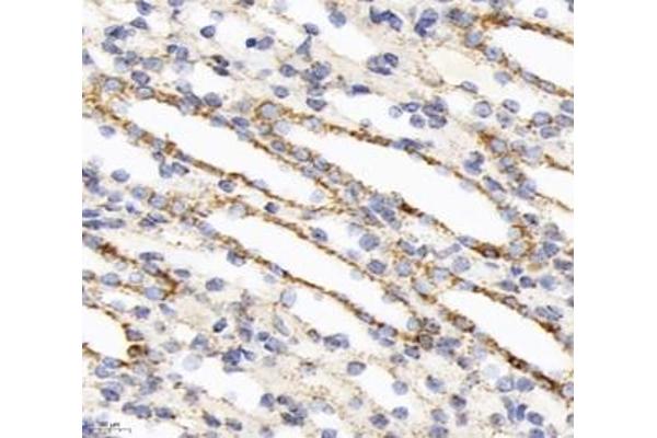 CYB561 antibody
