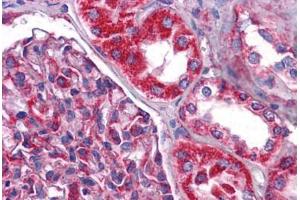 Human Kidney: Formalin-Fixed, Paraffin-Embedded (FFPE) (NDUFB9 antibody  (C-Term))