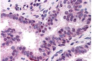 Human Prostate (formalin-fixed, paraffin-embedded) stained with NFYA antibody ABIN218318 at 1:400 followed by biotinylated goat anti-rabbit IgG secondary antibody ABIN481713, alkaline phosphatase-streptavidin and chromogen. (NFYA antibody  (N-Term))