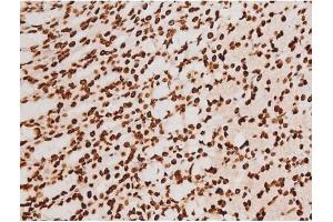 Immunohistochemistry (IHC) image for anti-REL proto-oncogene (c-Rel) (pSer503) antibody (ABIN6255382)