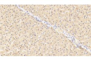 Detection of GRN in Human Liver Tissue using Polyclonal Antibody to Granulin (GRN) (Granulin antibody  (AA 361-585))