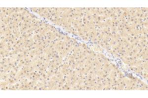 Detection of GRN in Human Liver Tissue using Polyclonal Antibody to Granulin (GRN) (Granulin antibody  (AA 361-585))