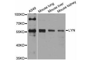 Western blot analysis of extracts of various cell lines, using Lyn antibody (ABIN4904272) at 1:1000 dilution.