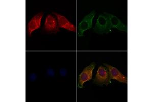 ABIN7094110 and ABIN7098154 staining Hela cells by IF/ICC. (CALU antibody  (Internal Region))