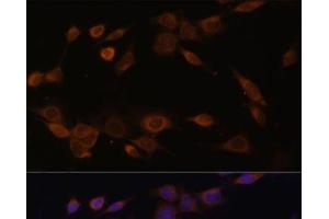 Immunofluorescence analysis of NIH-3T3 cells using POR Polyclonal Antibody at dilution of 1:100 (40x lens). (POR antibody)