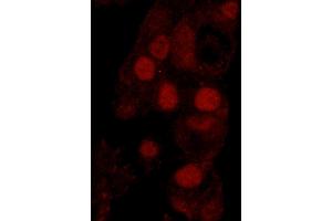 Immunofluorescence (IF) image for anti-Werner Helicase Interacting Protein 1 (WRNIP1) (AA 400-450) antibody (ABIN7449035) (WRNIP1 antibody  (AA 400-450))