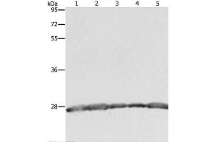 Western Blot analysis of Hela, 293T and MCF7 cell, Human fetal brain tissue and Jurkat cell using PRDX3 Polyclonal Antibody at dilution of 1:800