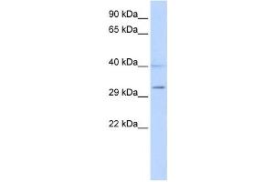 Western Blotting (WB) image for anti-Sirtuin 5 (SIRT5) antibody (ABIN2458471) (SIRT5 antibody)