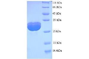 SDS-PAGE (SDS) image for TATA Box Binding Protein (TBP) (AA 2-240) protein (His tag) (ABIN5713872)